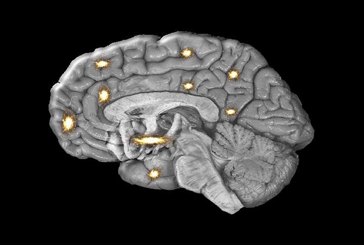 Brain Pain Map Expansion