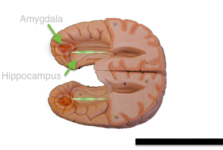 amygdala small
